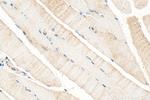 DMPK Antibody in Immunohistochemistry (Paraffin) (IHC (P))