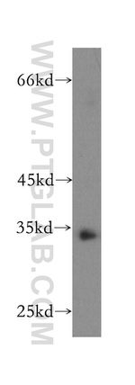 NPL Antibody in Western Blot (WB)