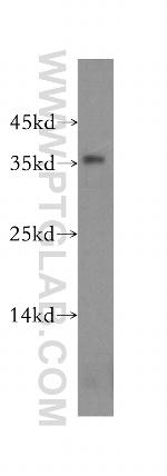 NPL Antibody in Western Blot (WB)
