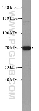 GALNT3 Antibody in Western Blot (WB)