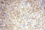 NDUFB11 Antibody in Immunohistochemistry (Paraffin) (IHC (P))