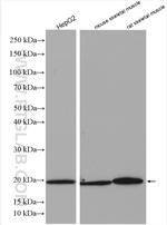 NDUFB11 Antibody in Western Blot (WB)