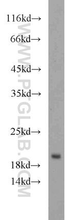 NDUFB11 Antibody in Western Blot (WB)