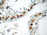 TRMT6 Antibody in Immunohistochemistry (Paraffin) (IHC (P))