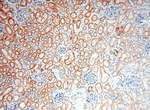 EXOSC10 Antibody in Immunohistochemistry (Paraffin) (IHC (P))