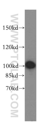 EXOSC10 Antibody in Western Blot (WB)