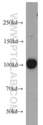EXOSC10 Antibody in Western Blot (WB)