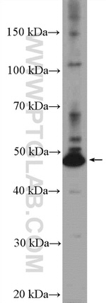 RILPL1 Antibody in Western Blot (WB)