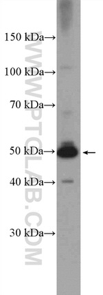 RILPL1 Antibody in Western Blot (WB)