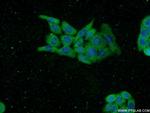 TASP1 Antibody in Immunocytochemistry (ICC/IF)