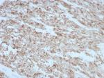 Desmin (Muscle Cell Marker) Recombinant Mouse Monoclonal Antibody (rDES/8846)