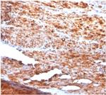 Desmin (Muscle Cell Marker) Monoclonal Antibody (rDES/1711)