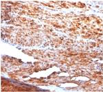 Desmin (Muscle Cell Marker) Recombinant Mouse Monoclonal Antibody (rDES/1711)