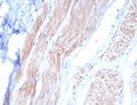 Desmin (Muscle Cell Marker) Antibody in Immunohistochemistry (Paraffin) (IHC (P))