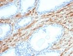 Desmin (Muscle Cell Marker) Antibody in Immunohistochemistry (Paraffin) (IHC (P))