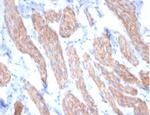 Desmin (Muscle Cell Marker) Antibody in Immunohistochemistry (Paraffin) (IHC (P))