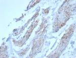 Desmin (Muscle Cell Marker) Antibody in Immunohistochemistry (Paraffin) (IHC (P))
