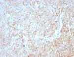 Desmin (Muscle Cell Marker) Antibody in Immunohistochemistry (Paraffin) (IHC (P))