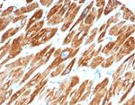 Desmin (Muscle Cell Marker) Antibody in Immunohistochemistry (Paraffin) (IHC (P))
