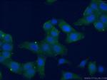 RPL15 Antibody in Immunocytochemistry (ICC/IF)