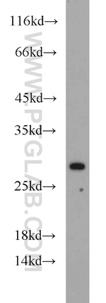 RPL15 Antibody in Western Blot (WB)