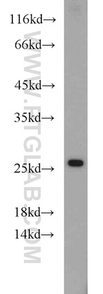 RPL15 Antibody in Western Blot (WB)