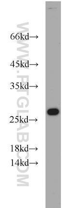 RPL15 Antibody in Western Blot (WB)