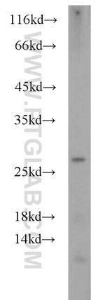 RPL15 Antibody in Western Blot (WB)