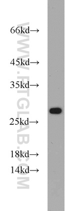 RPL15 Antibody in Western Blot (WB)