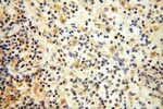 IL15RA Antibody in Immunohistochemistry (Paraffin) (IHC (P))
