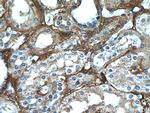 Fibrinogen beta chain Antibody in Immunohistochemistry (Paraffin) (IHC (P))