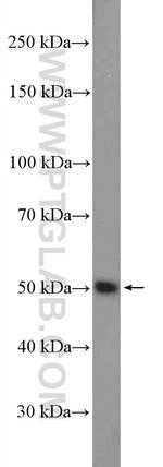 Fibrinogen beta chain Antibody in Western Blot (WB)