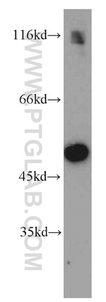 Fibrinogen beta chain Antibody in Western Blot (WB)