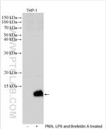 MIP-1 Alpha/CCL3 Antibody in Western Blot (WB)