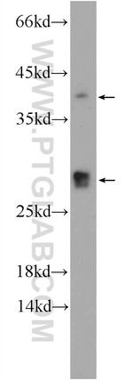CENPN Antibody in Western Blot (WB)