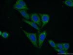PCK1 Antibody in Immunocytochemistry (ICC/IF)