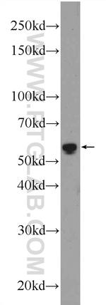 GPT2 Antibody in Western Blot (WB)