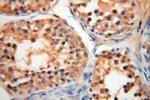 AGPAT6 Antibody in Immunohistochemistry (Paraffin) (IHC (P))