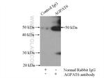 AGPAT6 Antibody in Immunoprecipitation (IP)