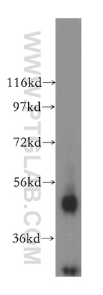 AGPAT6 Antibody in Western Blot (WB)