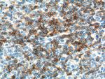 CD6 Antibody in Immunohistochemistry (Paraffin) (IHC (P))