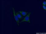 GSTM4 Antibody in Immunocytochemistry (ICC/IF)