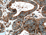GLT25D1 Antibody in Immunohistochemistry (Paraffin) (IHC (P))