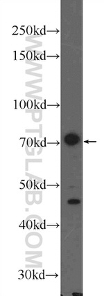 GLT25D1 Antibody in Western Blot (WB)