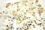 SPAG11A Antibody in Immunohistochemistry (Paraffin) (IHC (P))
