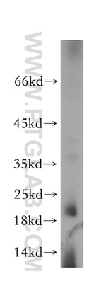 SPAG11A Antibody in Western Blot (WB)