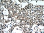 NEDD8 Antibody in Immunohistochemistry (Paraffin) (IHC (P))