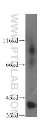 DNAJB12 Antibody in Western Blot (WB)