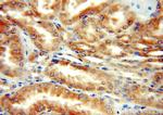 DcR2 Antibody in Immunohistochemistry (Paraffin) (IHC (P))