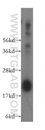DCTD Antibody in Western Blot (WB)